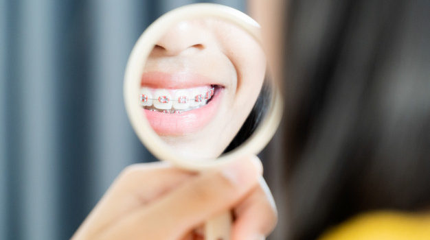 girl-with-braces-teeth-smiling-happy