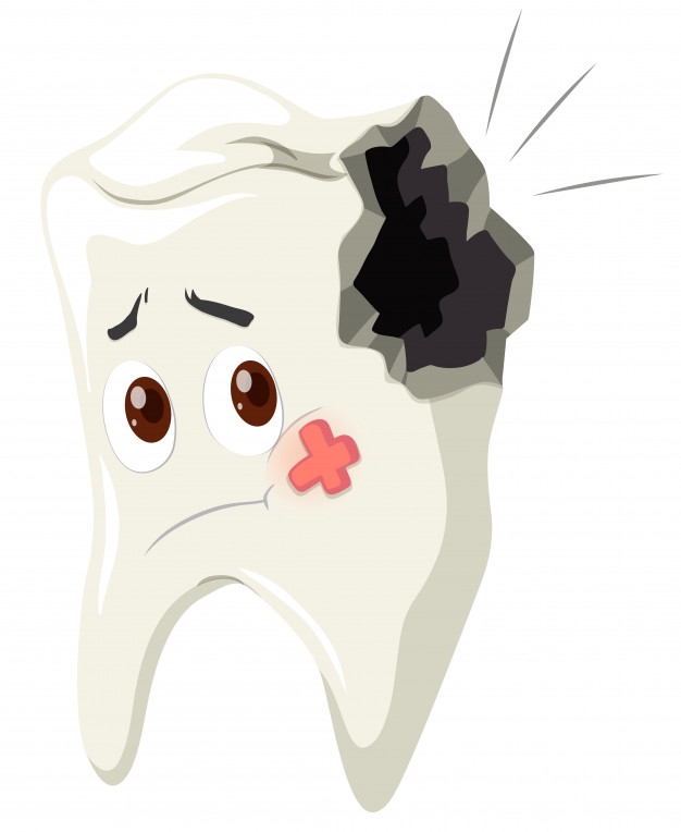 Dental Cavity